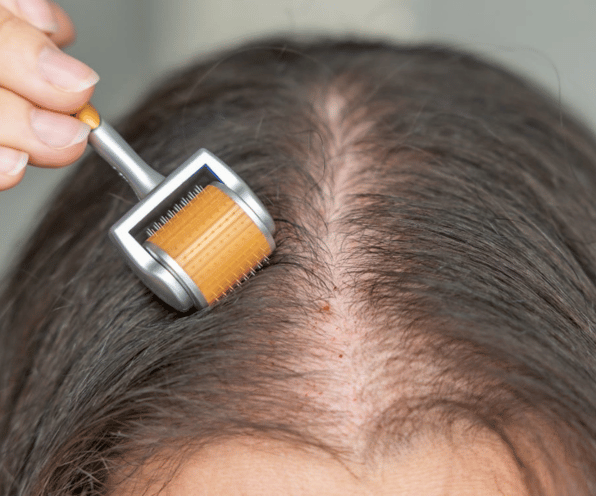 Hair Exosome Treatment - Advanced Hair Regrowth & Scalp Rejuvenation